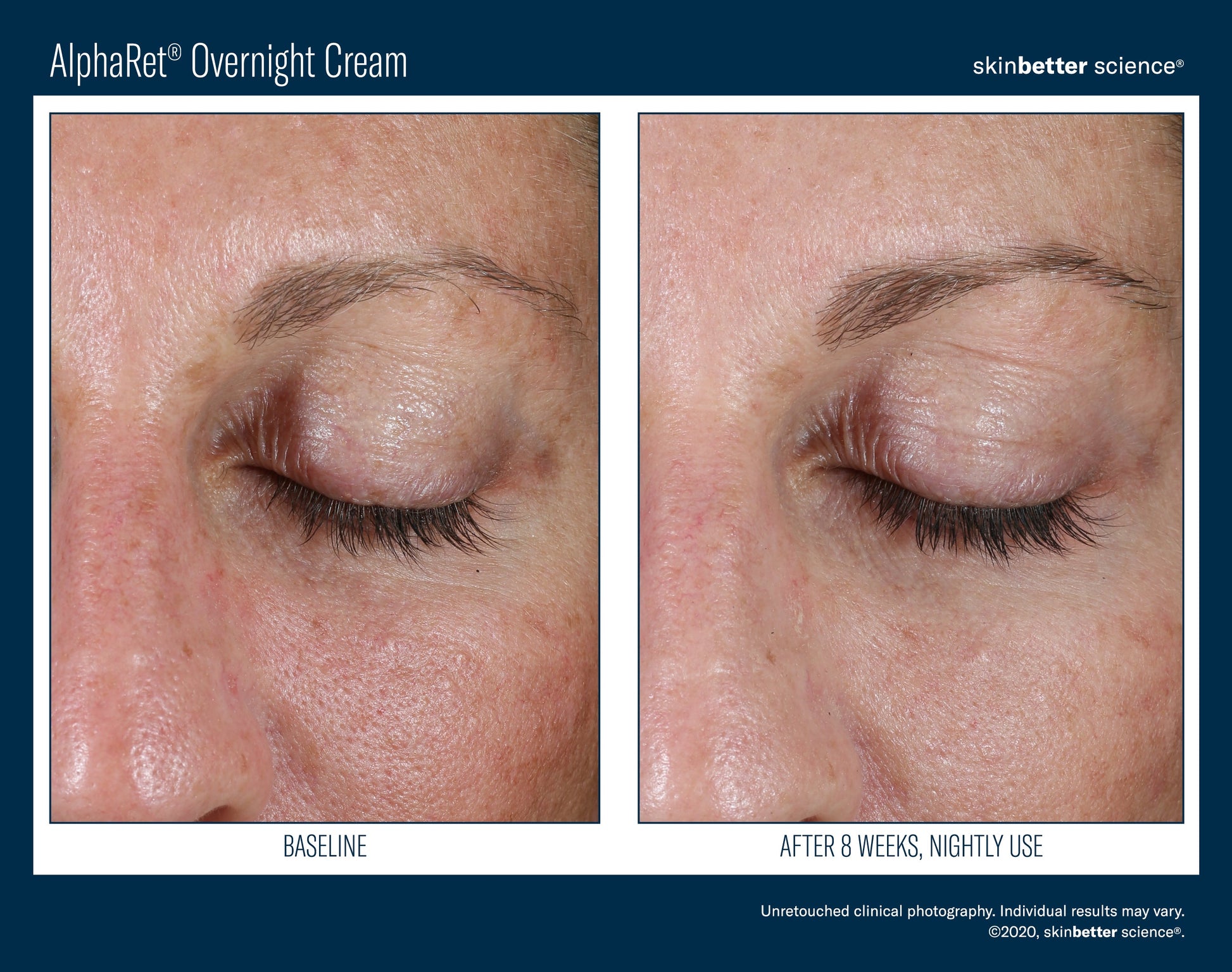 AlphaRet Overnight Cream 50 ml