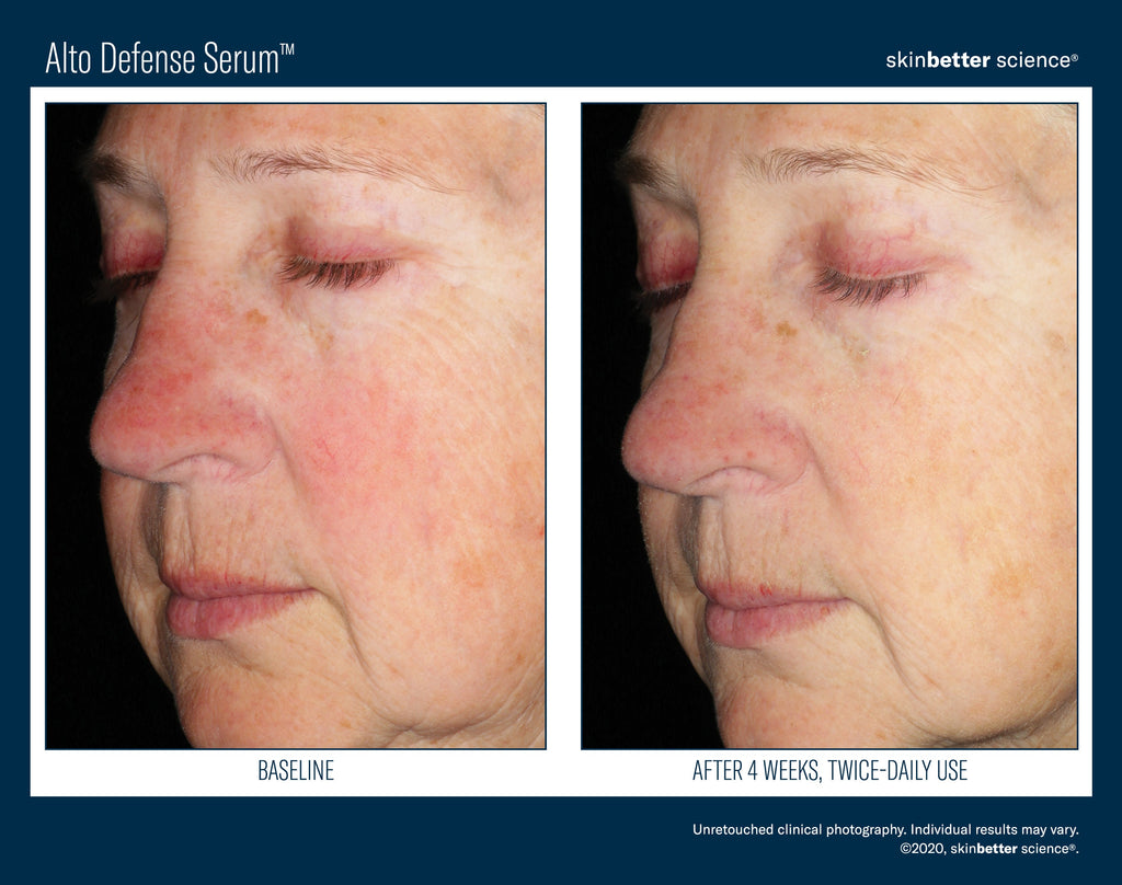 Alto Defense Serum 50 ml