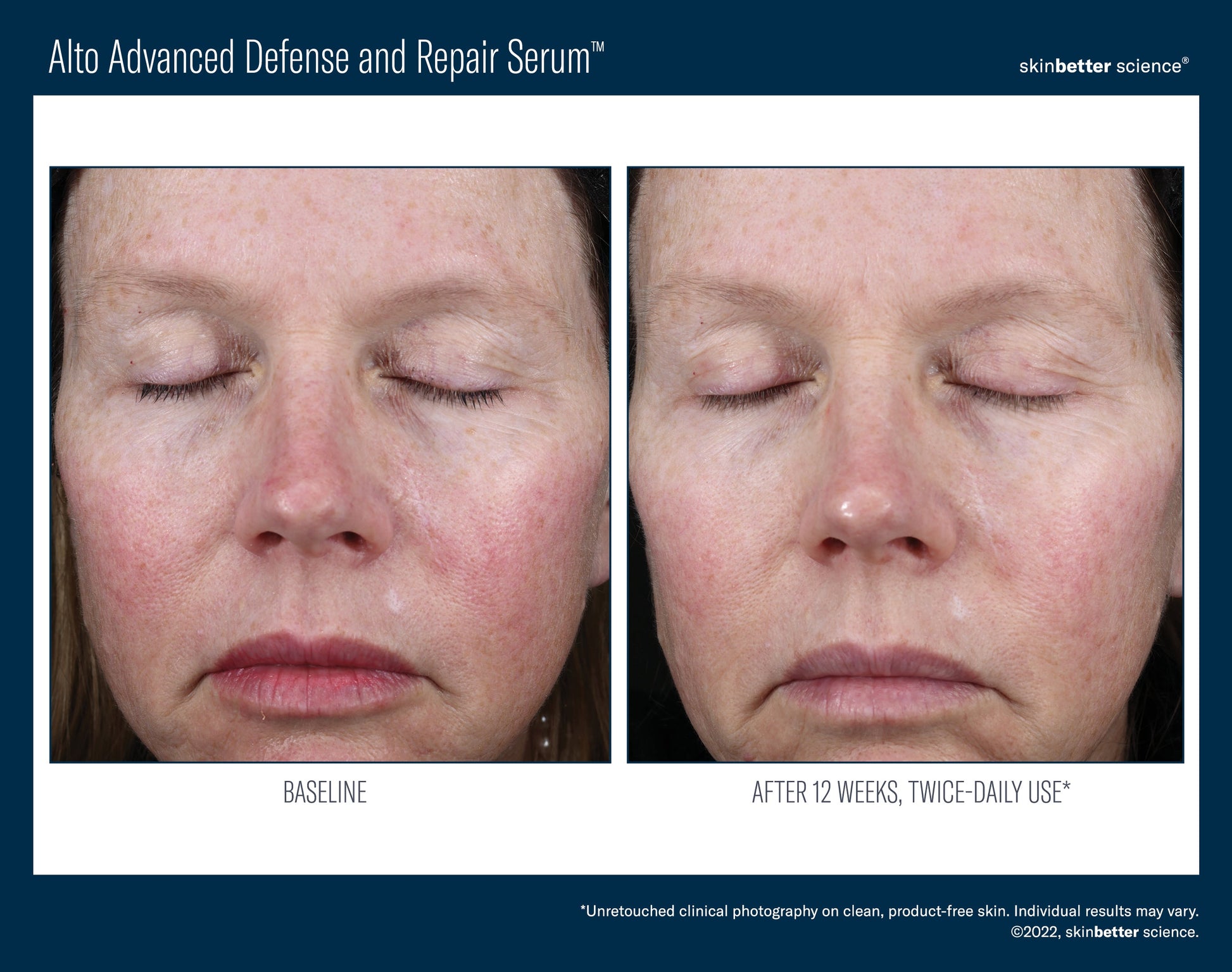 Alto Advanced Defense and Repair Serum 50 ml