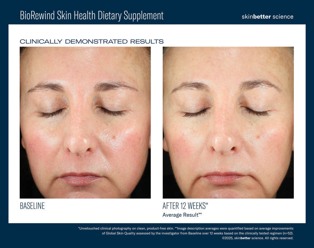 BioRewind Skin Health Dietary Supplement 60 ct