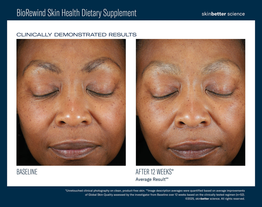 BioRewind Skin Health Dietary Supplement 60 ct
