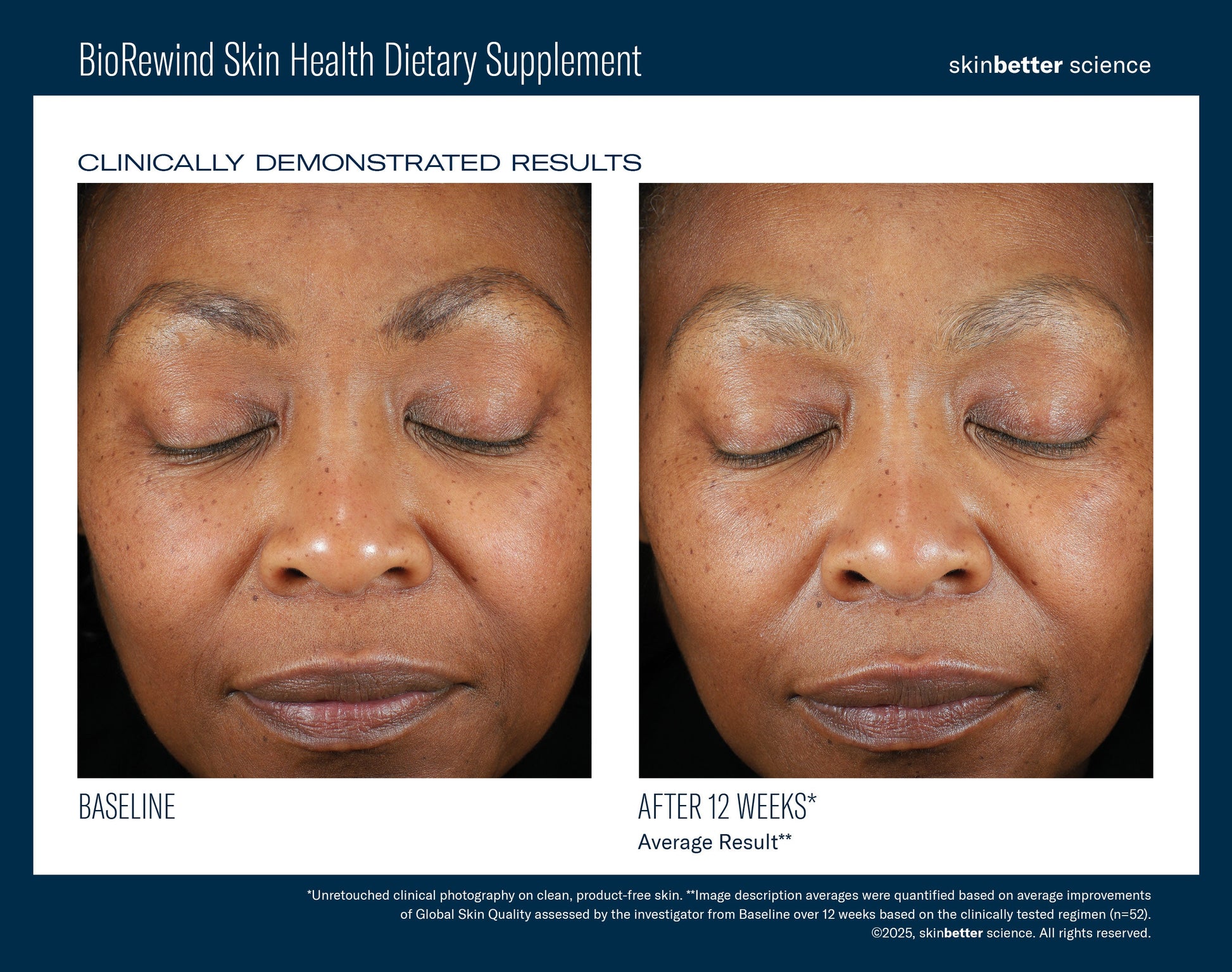 BioRewind Skin Health Dietary Supplement 60 ct