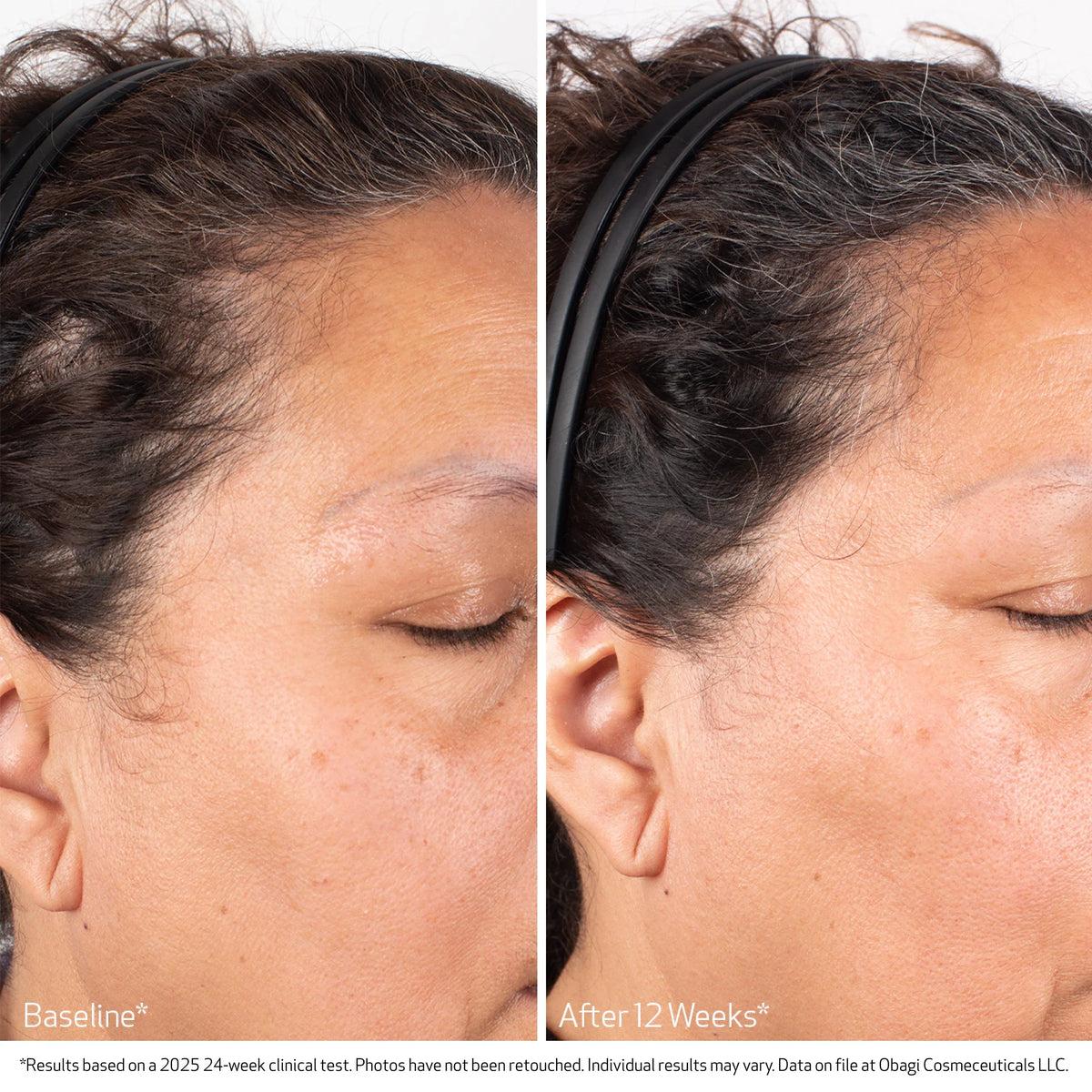Nu-Cil Biostim Scalp Serum