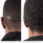 Nu-Cil Biostim Scalp Serum
