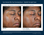 Even Intensive Skin Tone Correcting Serum 50 ml
