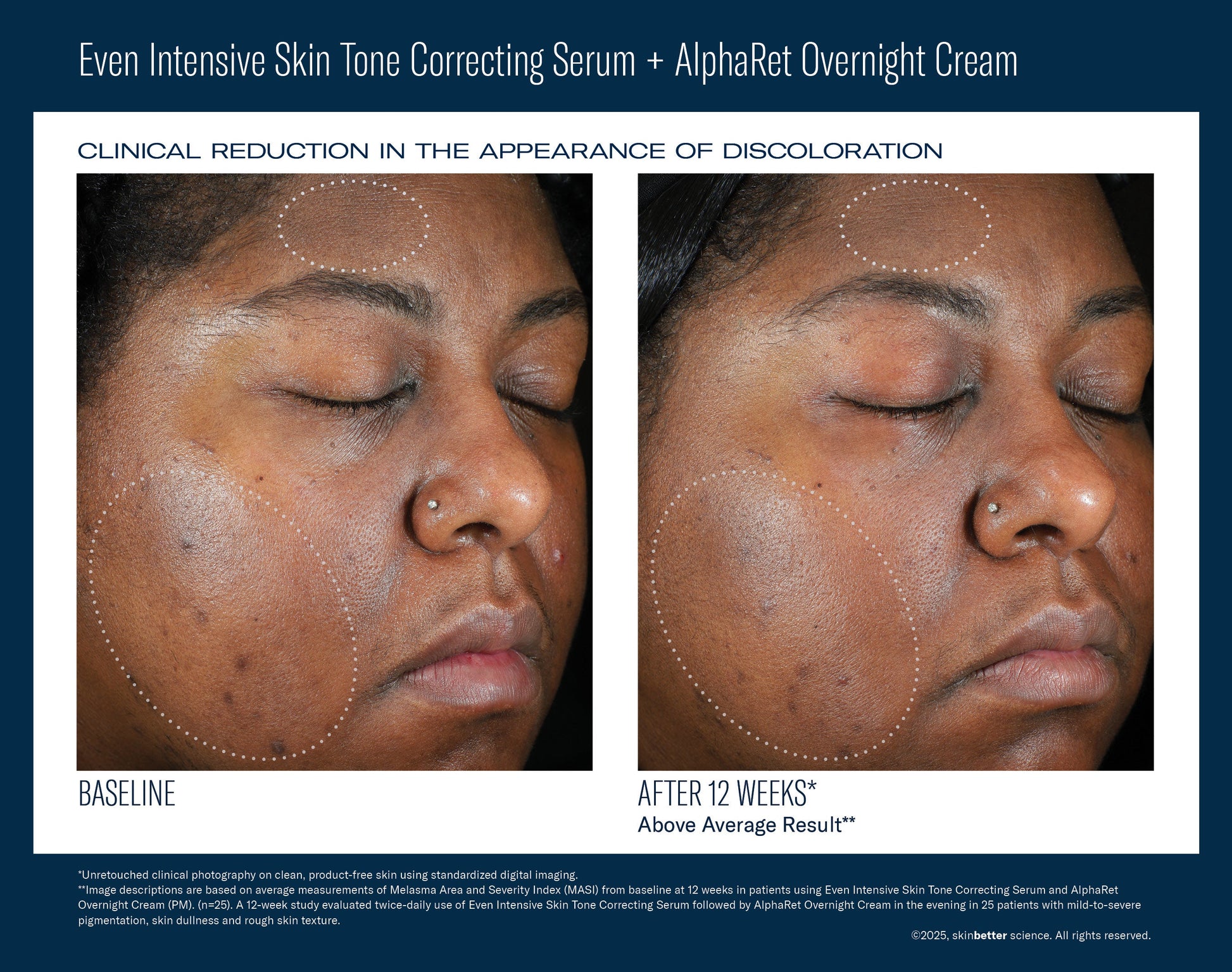 Even Intensive Skin Tone Correcting Serum 50 ml