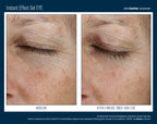 Instant Effect Gel EYE 15 ml