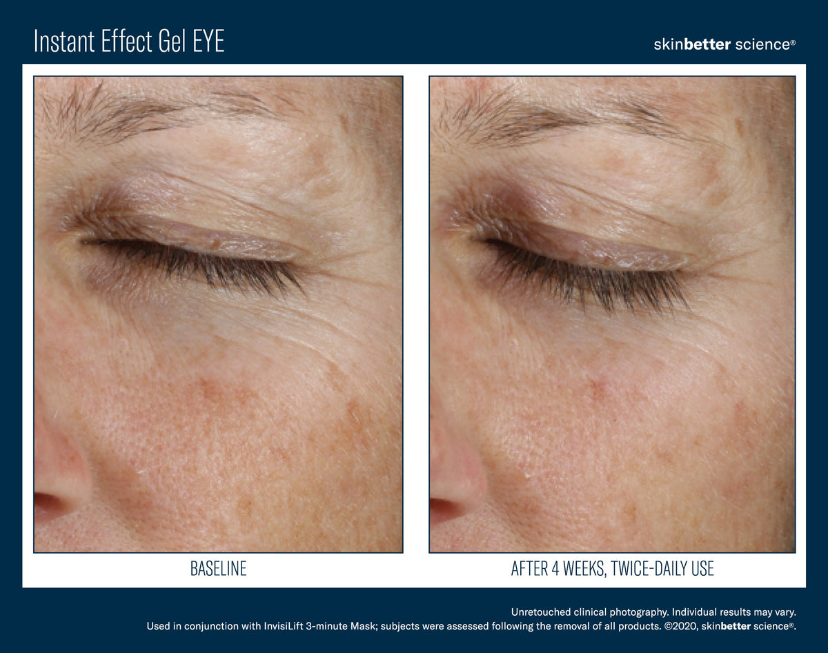 Instant Effect Gel EYE 15 ml