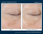 InterFuse Treatment Cream EYE 15 ml