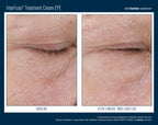 InterFuse Treatment Cream EYE 15 ml
