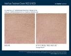 InterFuse Treatment Cream FACE & NECK 30 ml