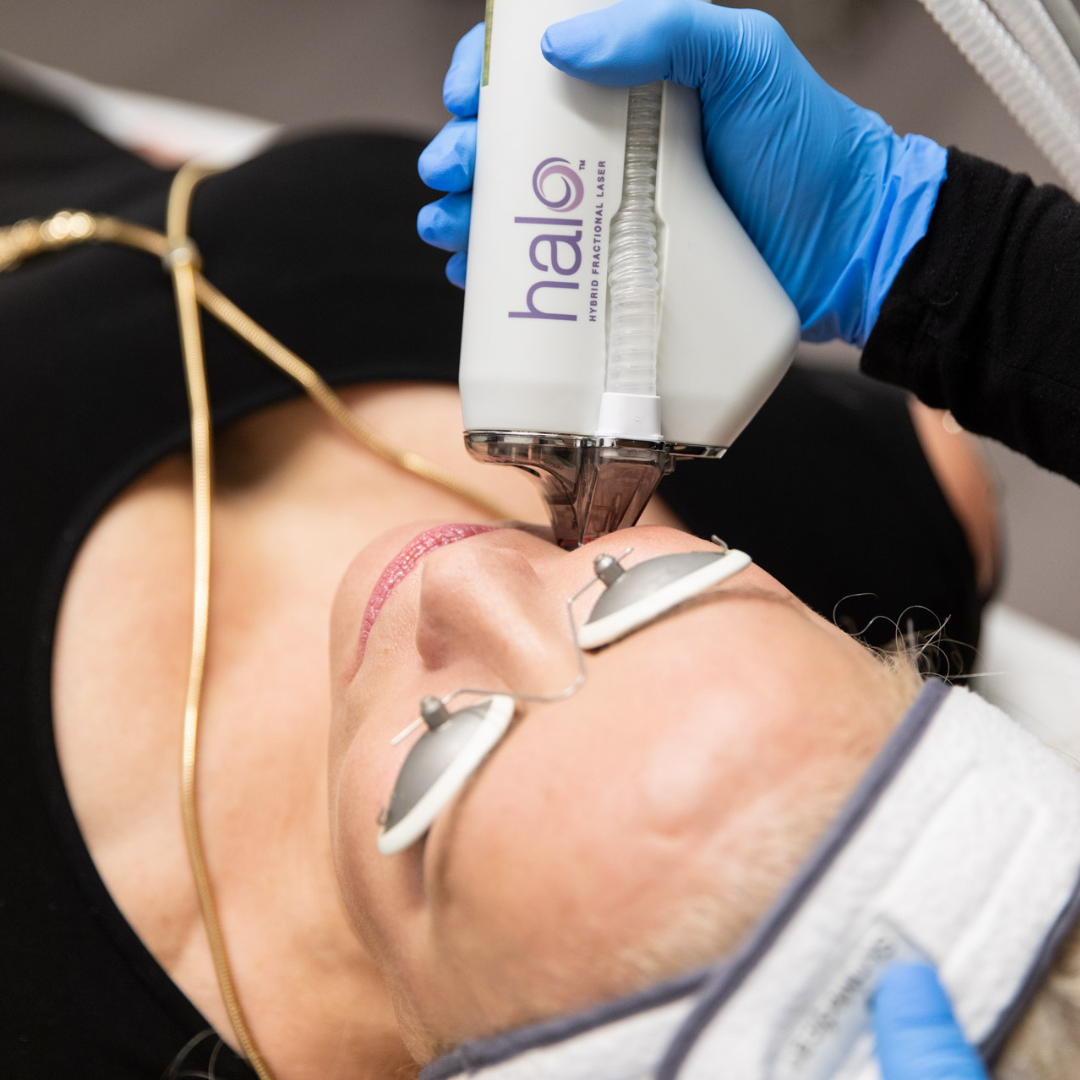 Buy 2 Halo Face Treatments — Get Hands, Neck, or Chest FREE! Plus, a Post-Care Kit!