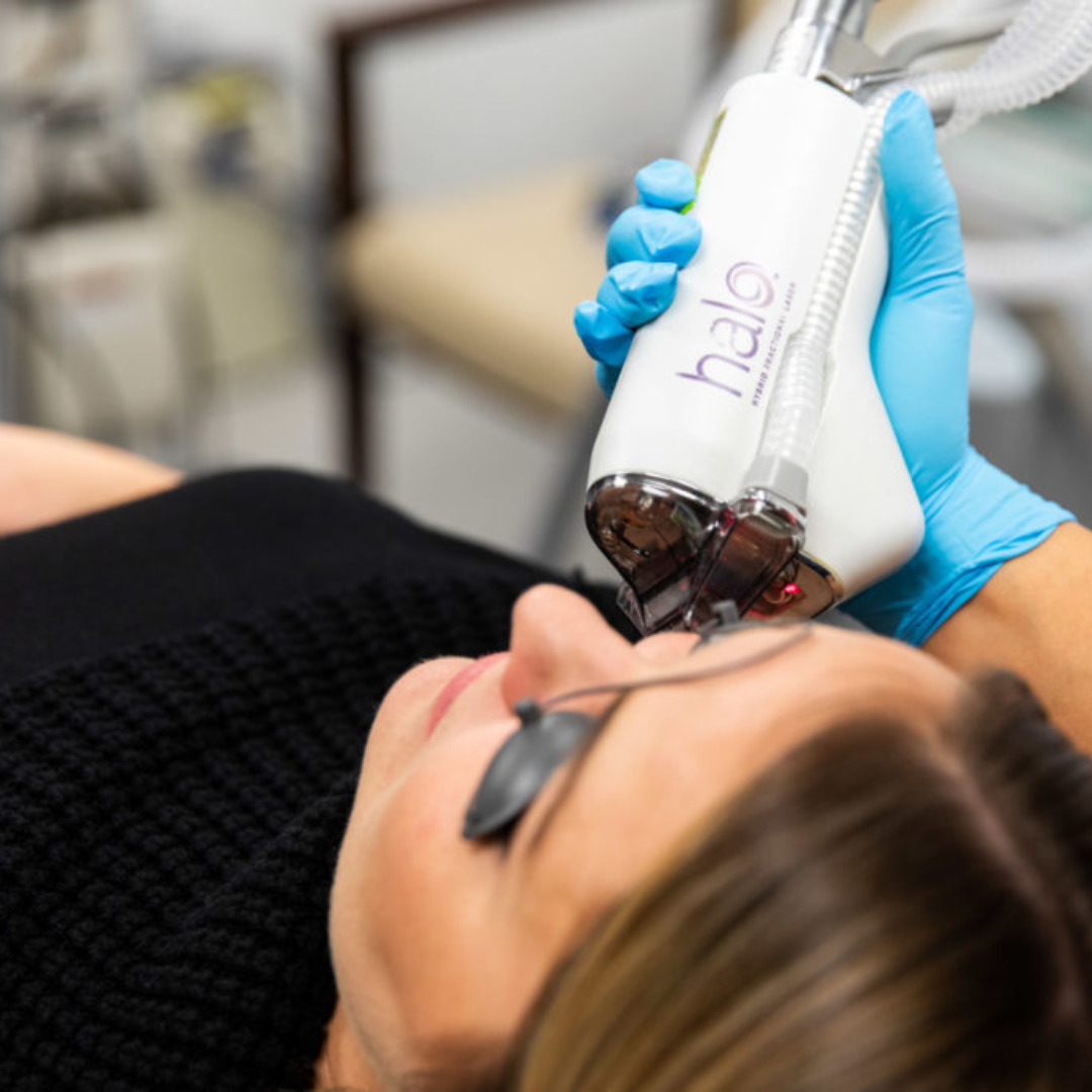 Buy 1 BBL Halo Face Treatment — Get Hands, Neck, or Chest FREE! Plus, a post-care treatment kit.