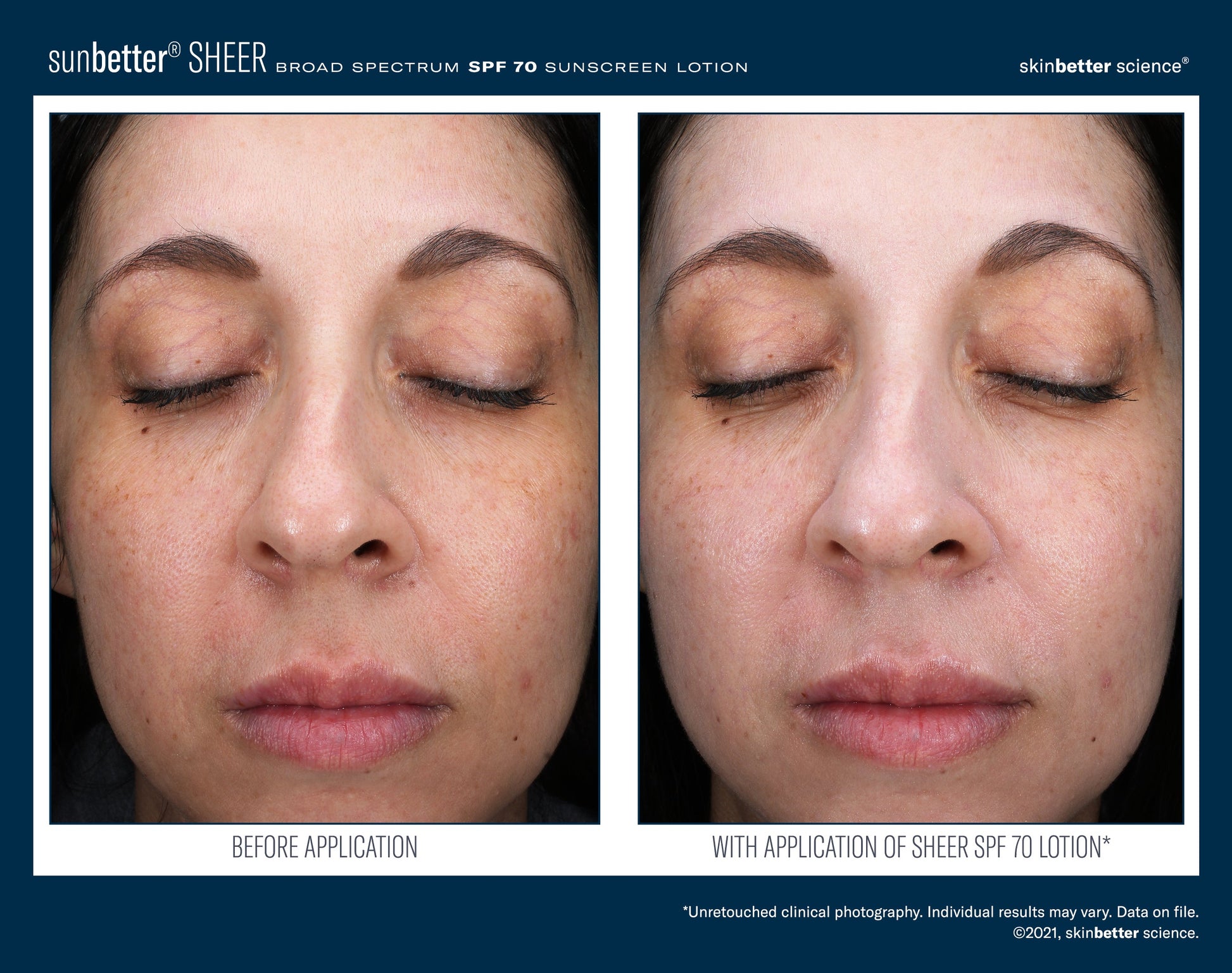 SunBetter SHEER SPF 70 Sunscreen Lotion 50 ml