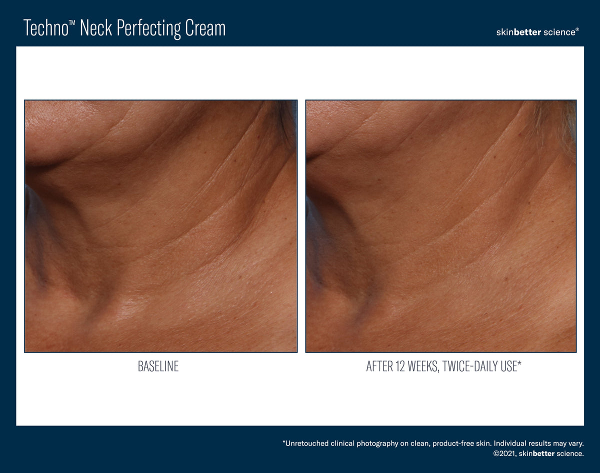Techno Neck Perfecting Cream