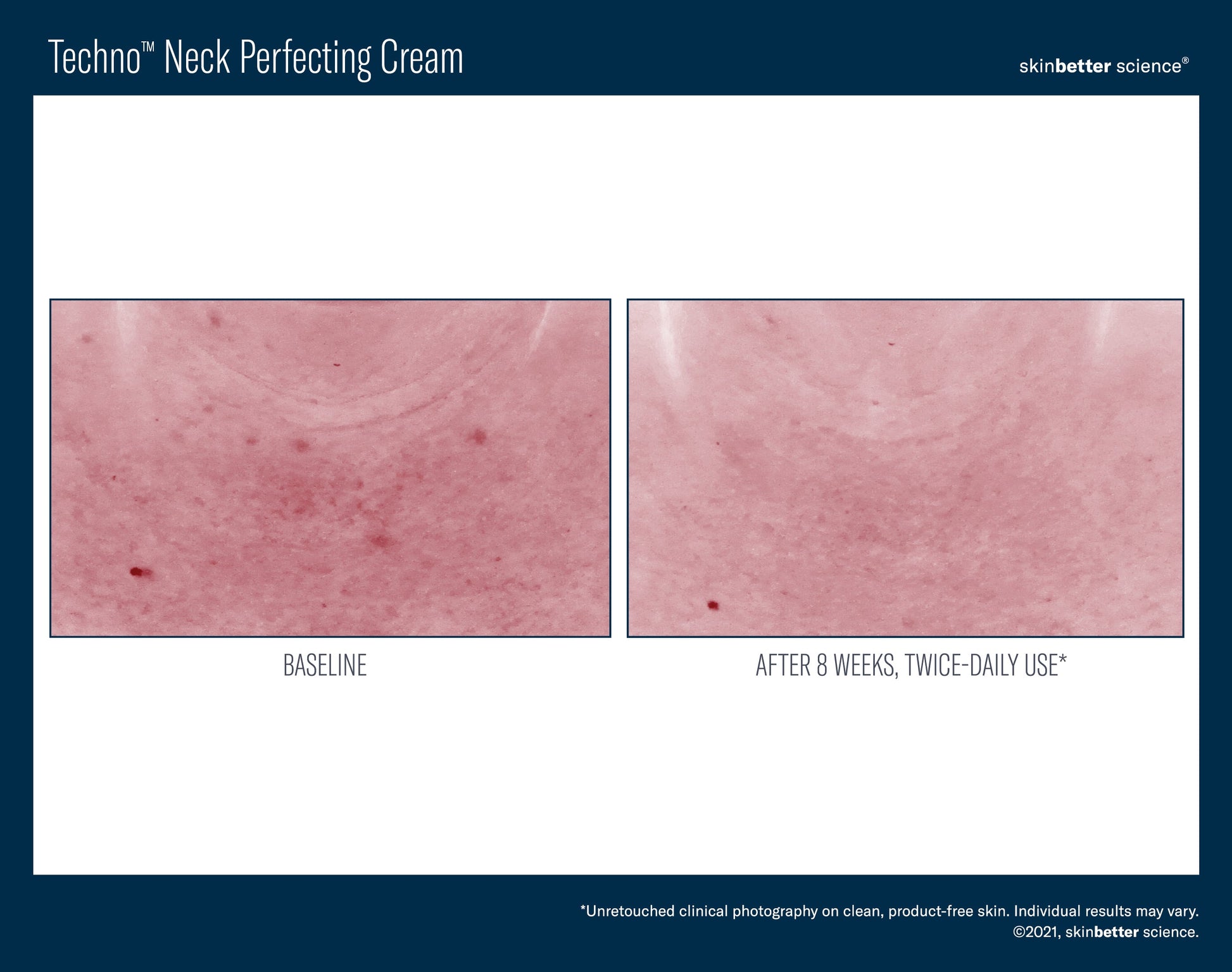 Techno Neck Perfecting Cream