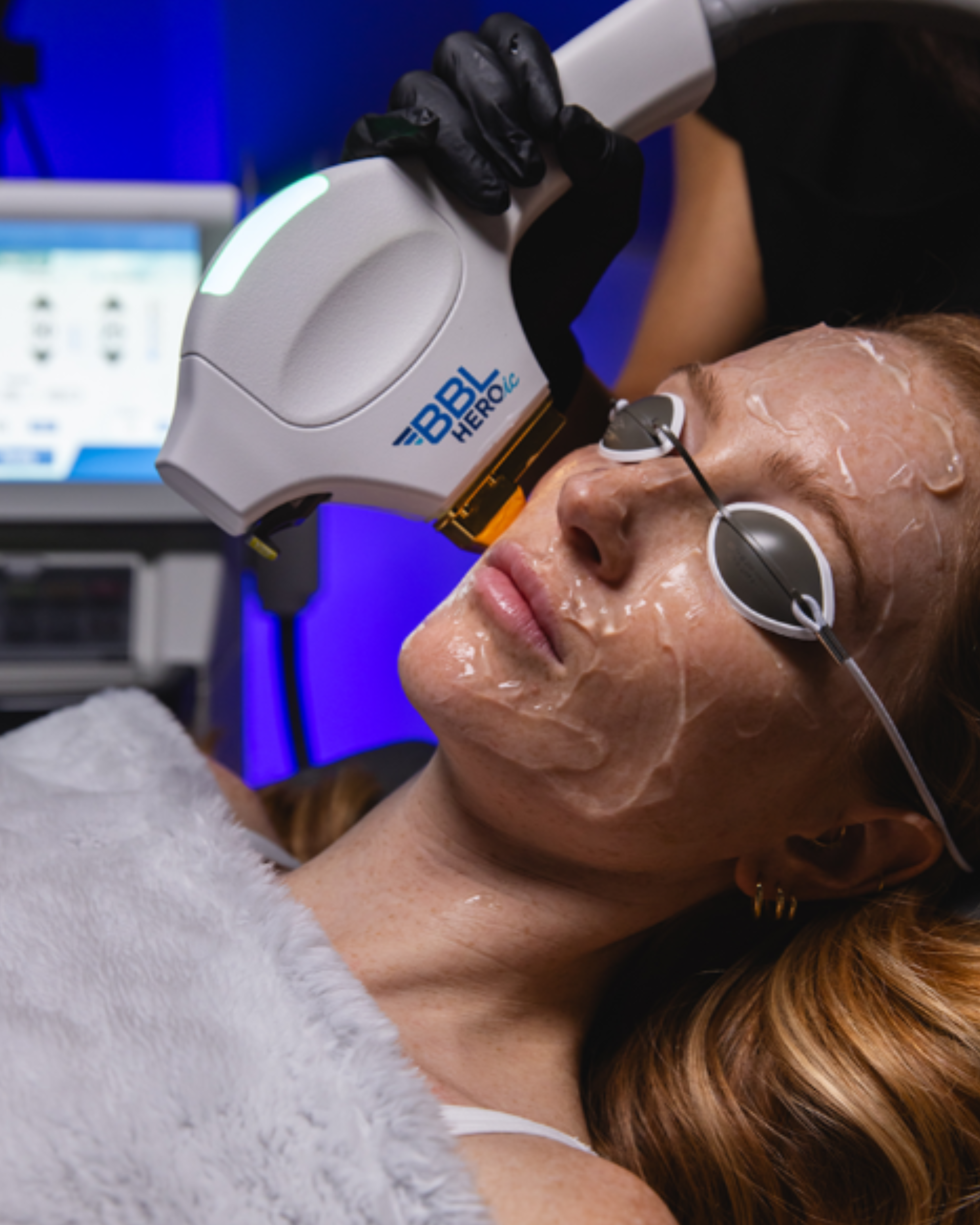 Buy 2 BBL Treatments— Get a FREE Obagi Clear!