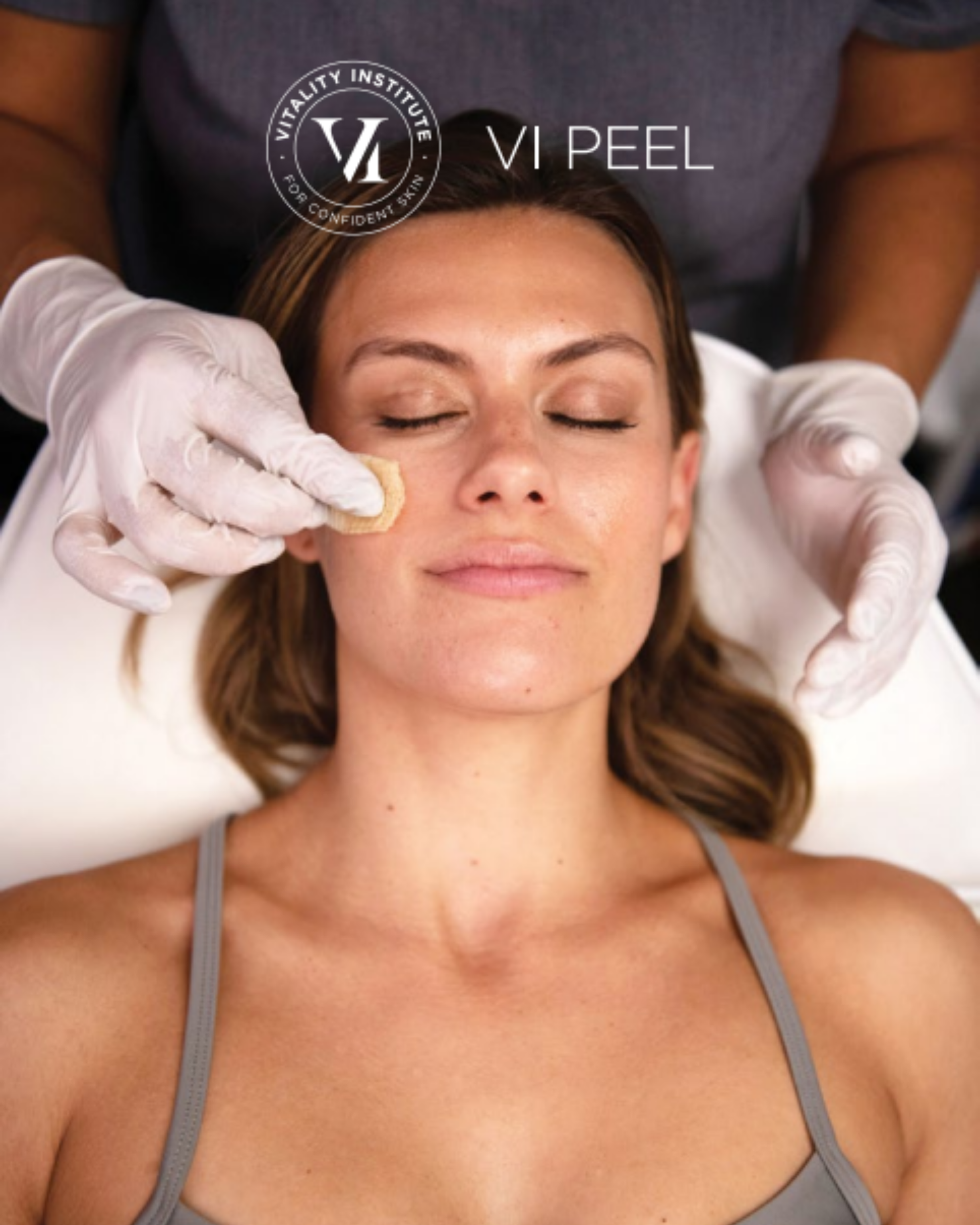 Buy 3 VI Peels — Get 1 HydraFacial FREE!